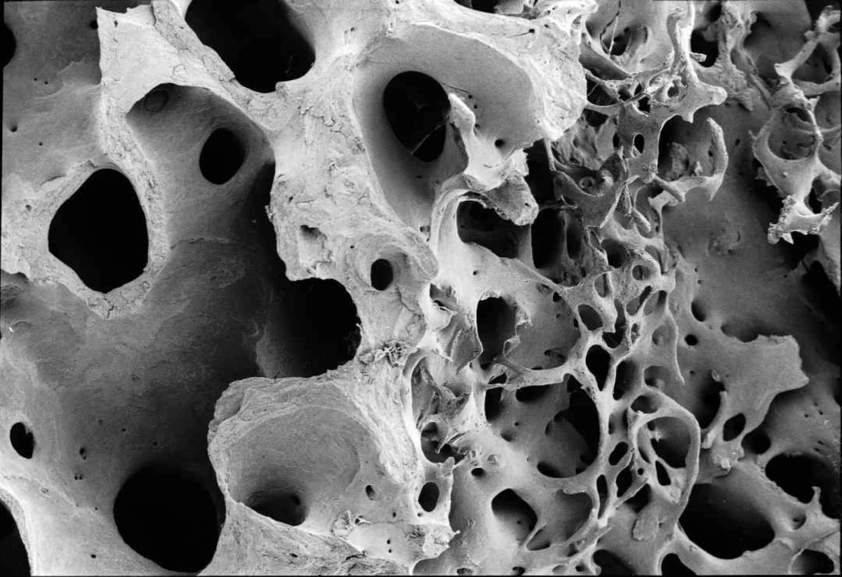 La struttura interna di un osso determina la densità ossea